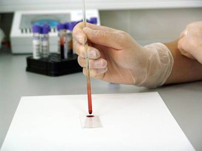 Немецкие ученые: COVID-19 оказался способен влиять на клетки крови - rosbalt.ru