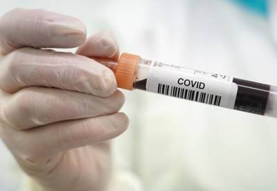 COVID меняет клетки крови переболевших - ученые - facenews.ua
