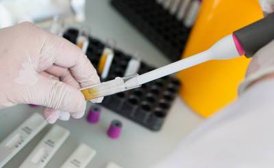 ПЦР-тест для детей, отправляющихся в лагеря, будет бесплатным - podrobno.uz - Узбекистан - Ташкент