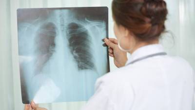 Коронавирус. В Украине 937 заболевших за сутки, больше всего в Киеве - liga.net - Киев