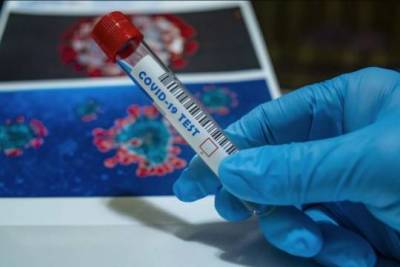 Российские лаборатории смогли рекордно заработать на коронавирусных тестах в июне - versia.ru