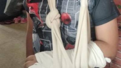 Урок физкультуры в Бат-Яме закончился в больнице: вратарем поставили мальчика с одной почкой - vesty.co.il - Израиль