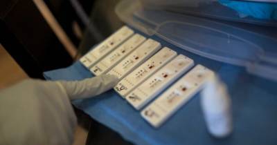 Тест на антитела у вакцинированных может быть отрицательным – МОЗ - prm.ua - Украина