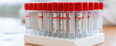 Новый тест на эффективность антител к коронавирусу запустили в России - runews24.ru - Россия - Пресс-Служба
