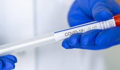 ФАС проверит рост цен на ПЦР-тесты и анализы на антитела к COVID-19 - og.ru - Россия