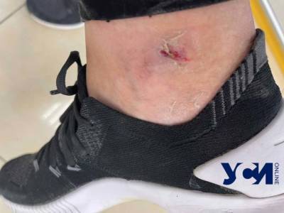 В центре Одессы парочка на самокатах разбила ногу женщине - odessa-life.od.ua - Россия - Одесса