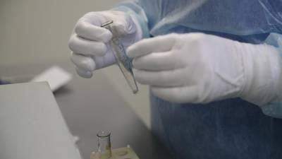 Тест на антитела после прививки «ЭпиВакКороной» стал доступен в обычных лабораториях - iz.ru - Израиль