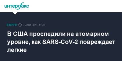 В США проследили на атомарном уровне, как SARS-CoV-2 повреждает легкие - interfax.ru - Москва - Сша