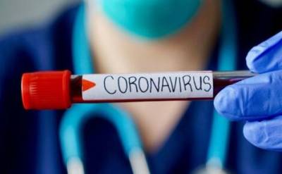 В России выявлено 10 407 случаев коронавируса - echo.msk.ru - Россия - Санкт-Петербург - Москва