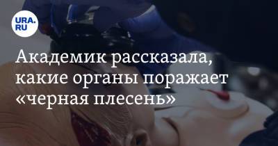 София Бурова - Академик рассказала, какие органы поражает «черная плесень» - ura.news