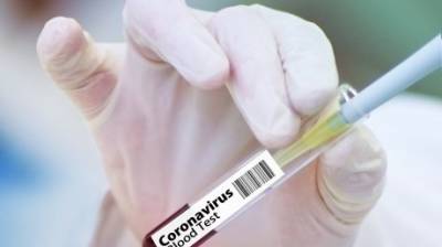 В области за сутки выявили более 130 заразившихся коронавирусом - penzainform.ru - Пенза - Пензенская обл. - Каменск - Спасск