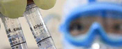 В Украине от COVID-19 вакцинировали более 83 тысяч человек за сутки - vchaspik.ua - Украина - Пресс-Служба