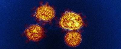 Штамм коронавируса Лямбда распространился в 29 странах. Что он нем известно - techno.bigmir.net - Венгрия