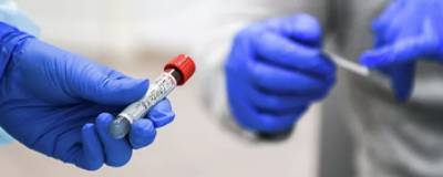 Ученые: Антитела после легкой формы ковида могут сохраняться в организме около года - runews24.ru - Стокгольм - Дандерид
