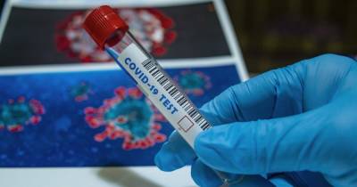 В ВСУ увеличилось количество новых случаев коронавирусной болезни - dsnews.ua