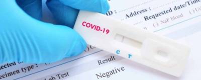 Уровень антител не влияет на необходимость вакцинации от коронавируса - runews24.ru