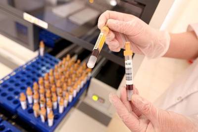 ФМБА начало испытания новой вакцины от COVID-19 - vm.ru