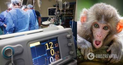 В Китае человек впервые умер от вируса обезьян - obozrevatel.com - Китай