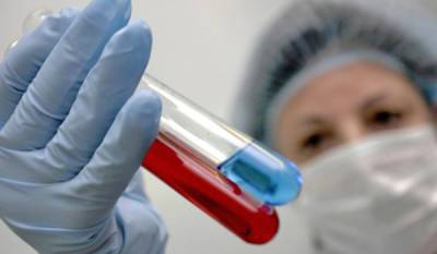 Российские ученые запатентовали эффективный способ лечения ВИЧ - nakanune.ru