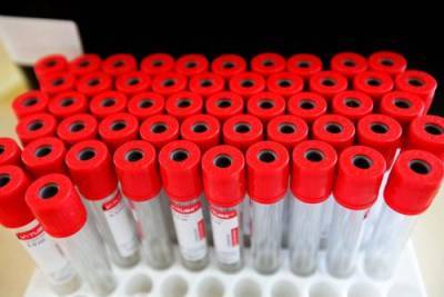 В ВОЗ заявили, что смертность от коронавируса выросла за неделю в мире более чем на 20% - argumenti.ru