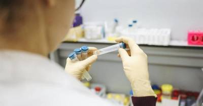 Ученые заявили о создании самых эффективных антител к коронавирусу - skuke.net