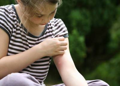 Первая помощь: чем помазать ребенка при кожном зуде после укусов насекомых - province.ru