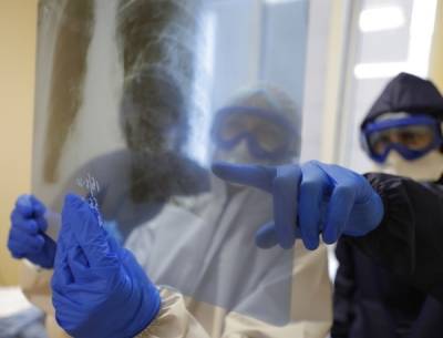 В НИИ Склифосовского заявили о развитии тромбоза из-за COVID-19 - govoritmoskva.ru - Россия - Москва