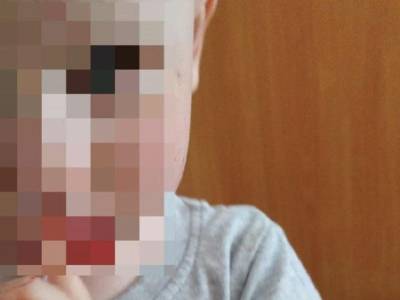 Малыша забрали из частного детского сада в Ставрополе с кровавыми ссадинами на лице - bloknot.ru
