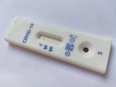 Исследование: Ранние симптомы COVID-19 различаются в зависимости от возраста - ufacitynews.ru