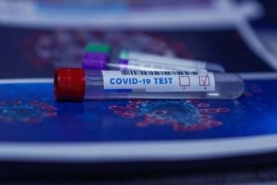 Более 506 тысяч тестов на коронавирус сделали в Смоленской области - mk-smolensk.ru - Смоленская обл.