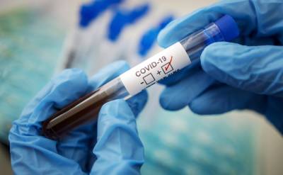 Жителям Нидерландов начали выдавать бесплатные тесты на коронавирус - ru.slovoidilo.ua - Украина - Голландия - Пресс-Служба