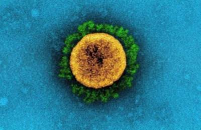 В США распространяется штамм коронавируса с летальностью более 80% - topcor.ru - Сша - Нью-Йорк - Колумбия - Нью-Йорк