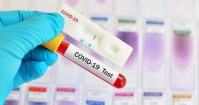 70 новых случаев заражения коронавирусом за сутки - dialog.tj - Таджикистан