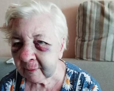В Волгограде 84-летнюю избитую пенсионерку в 4 утра выставили из больницы - bloknot.ru - Волгоград