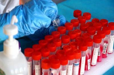 В России впервые с конца июня выявили менее 21 тысячи случаев заражения коронавирусом - argumenti.ru - Россия