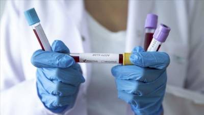 Ученые выявили неожиданное последствие коронавируса - enovosty.com - Сша