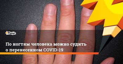 По ногтям человека можно судить о перенесенном COVID-19 - ridus.ru - Ирландия