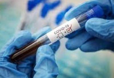 В Украине за сутки обнаружили 1560 новых случаев коронавируса - facenews.ua - Украина