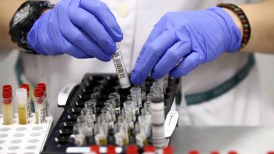 COVID-19 в СНГ: круглосуточная ПЦР-лаборатория открылась в Минске, новую вакцину исследуют в Казахстане - mir24.tv - Белоруссия - Казахстан - Минск - Снг - Грузия - Тбилиси