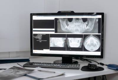 В Свирской и Гатчинской больницах завершают ремонт рентген-кабинетов - online47.ru