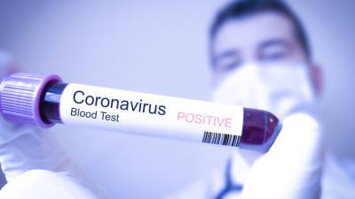 Еще у 18 человек, связанных с Олимпиадой в Токио, выявили коронавирус - mir24.tv - Япония - Греция - Токио