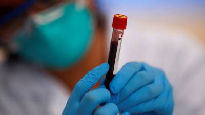 Власти Китая объявили о массовом тестировании на коронавирус в Ухане - russian.rt.com - Китай - Ухань
