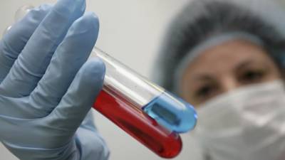 Дмитрий Лиознов - Учёные предупредили о возможной активности гриппа в России - russian.rt.com - Россия