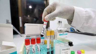Александр Гинцбург - В Молдавии за сутки выявили 216 случаев коронавируса - russian.rt.com - Молдавия