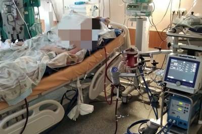 В Твери врачи спасли 16-летнюю пациентку с обширным поражением лёгких из-за COVID-19 - tverigrad.ru - Тверь