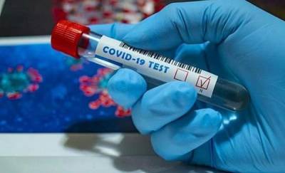 В Тюменской области выявили еще 77 случаев заражения коронавирусом - news.megatyumen.ru - Россия - Тюменская обл.