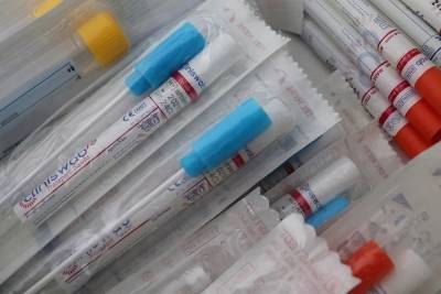 Германия: MDS ставит под сомнение результаты тестов на антитела - mknews.de - Германия