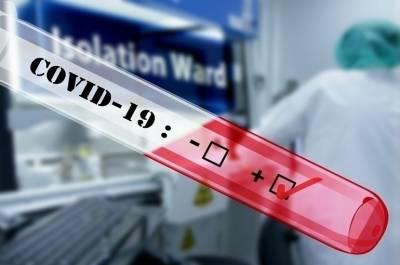 В Австрии хотят сократить срок действия тестов на коронавирус - pnp.ru - Австрия