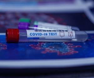 Почему тест-исследования на коронавирус не всегда достоверны - goodnews.ua