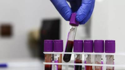 В России за сутки проведено почти 400 тысяч тестов на коронавирус - russian.rt.com - Россия